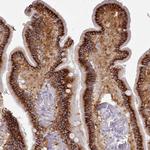 TMEM253 Polyclonal Antibody