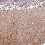 CMTM5 Antibody in Immunohistochemistry (Paraffin) (IHC (P))