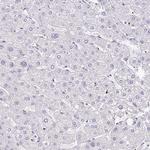 CMTM5 Antibody in Immunohistochemistry (Paraffin) (IHC (P))