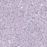 CMTM5 Antibody in Immunohistochemistry (Paraffin) (IHC (P))