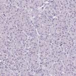 CMTM5 Antibody in Immunohistochemistry (IHC)