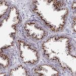 EFTUD1 Polyclonal Antibody