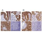 HGD Antibody in Immunohistochemistry (IHC)
