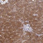 HGD Antibody in Immunohistochemistry (IHC)