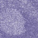 HGD Antibody in Immunohistochemistry (IHC)