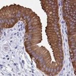 HGD Antibody in Immunohistochemistry (IHC)