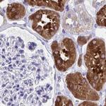 HGD Antibody in Immunohistochemistry (IHC)