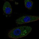 HGD Polyclonal Antibody
