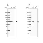 HGD Antibody in Western Blot (WB)