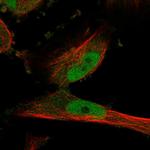 PDE1C Polyclonal Antibody