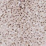PDE1C Antibody in Immunohistochemistry (Paraffin) (IHC (P))