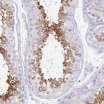 TRAF4 Antibody in Immunohistochemistry (Paraffin) (IHC (P))