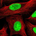 UTP18 Polyclonal Antibody