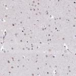 UTP18 Antibody in Immunohistochemistry (Paraffin) (IHC (P))