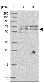 UTP18 Antibody in Western Blot (WB)