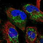 TTC19 Polyclonal Antibody