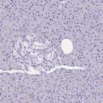 GSDMB Antibody in Immunohistochemistry (Paraffin) (IHC (P))