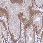 GSDMB Antibody in Immunohistochemistry (Paraffin) (IHC (P))