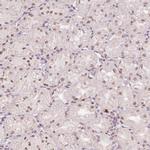 BCAS3 Polyclonal Antibody