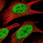 PHF23 Polyclonal Antibody