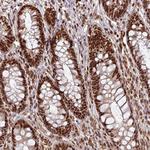 PHF23 Antibody in Immunohistochemistry (Paraffin) (IHC (P))