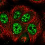 SRGAP1 Polyclonal Antibody