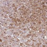 SRGAP1 Antibody in Immunohistochemistry (Paraffin) (IHC (P))