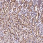 ZNF615 Antibody in Immunohistochemistry (Paraffin) (IHC (P))
