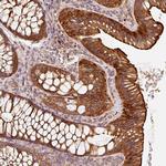 CEP95 Polyclonal Antibody