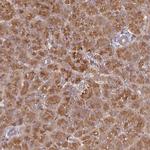 CEP95 Polyclonal Antibody