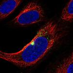 ZNF365 Polyclonal Antibody