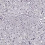 ZNF365 Antibody in Immunohistochemistry (Paraffin) (IHC (P))