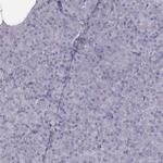 ZNF365 Antibody in Immunohistochemistry (Paraffin) (IHC (P))