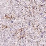 ZNF365 Antibody in Immunohistochemistry (IHC)