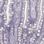 ZNF365 Antibody in Immunohistochemistry (IHC)