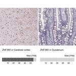 ZNF365 Antibody