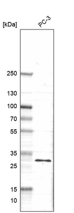 ZNF365 Antibody in Western Blot (WB)