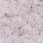 ZNF365 Antibody in Immunohistochemistry (IHC)