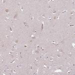 C4orf48 Antibody in Immunohistochemistry (Paraffin) (IHC (P))