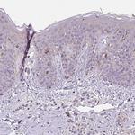 C4orf48 Antibody in Immunohistochemistry (Paraffin) (IHC (P))