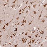 KLC1 Polyclonal Antibody