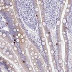 PRAP1 Polyclonal Antibody