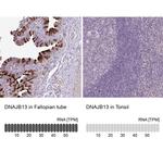 DNAJB13 Polyclonal Antibody