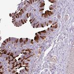 DNAJB13 Antibody in Immunohistochemistry (IHC)