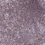 KLF16 Antibody in Immunohistochemistry (Paraffin) (IHC (P))