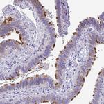 TTC30A Antibody in Immunohistochemistry (Paraffin) (IHC (P))