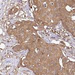 GSPT1 Antibody in Immunohistochemistry (IHC)