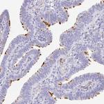 LDLRAD1 Polyclonal Antibody