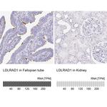 LDLRAD1 Antibody in Immunohistochemistry (IHC)