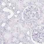LDLRAD1 Antibody in Immunohistochemistry (IHC)